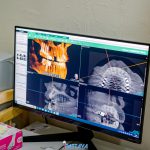 LINE_ALBUM_Dental Point_230623_44