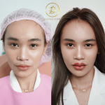 รีวิวปาก-มิ้น